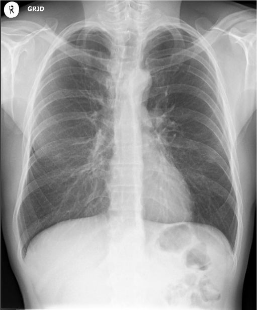X-Ray image